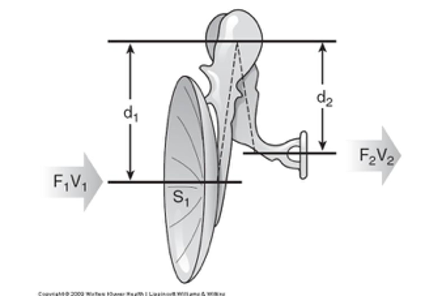 <p>The handle of Malleus 1.3 times longer than the Long process of Incus, providing Mechanical Leverage Advantage.</p><p>So, Ossicles increases force of movement by 1.3 times.</p>