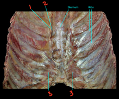 <p>What is labeled 3?</p>
