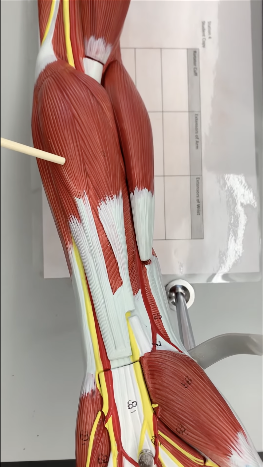 <p>Palmaris Longus</p>