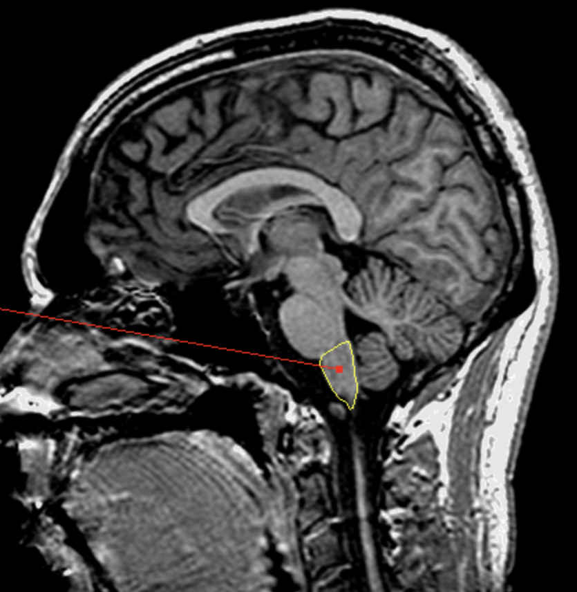<p>What is the area highlighted called?</p>