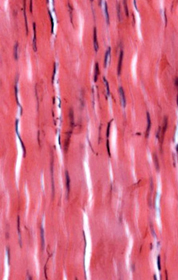 <p>fxn: attaches muscles to bone or to muscle, found in tendons, most ligaments, aponeuroses</p>