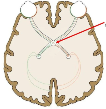 <p>A structure in the visual system that allows for one image to be created from both eyes.</p>