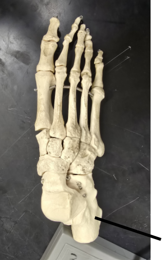 <p>Name Tarsal Bone</p>