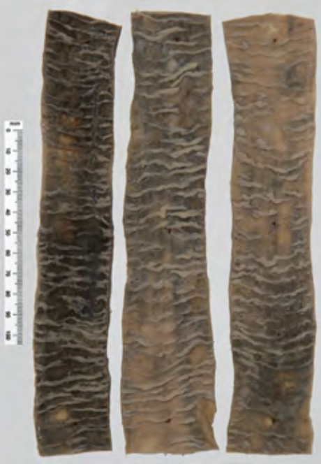<p>Identify the POT</p>