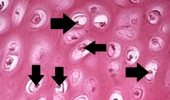 <p>cells in the cartilage matrix</p>