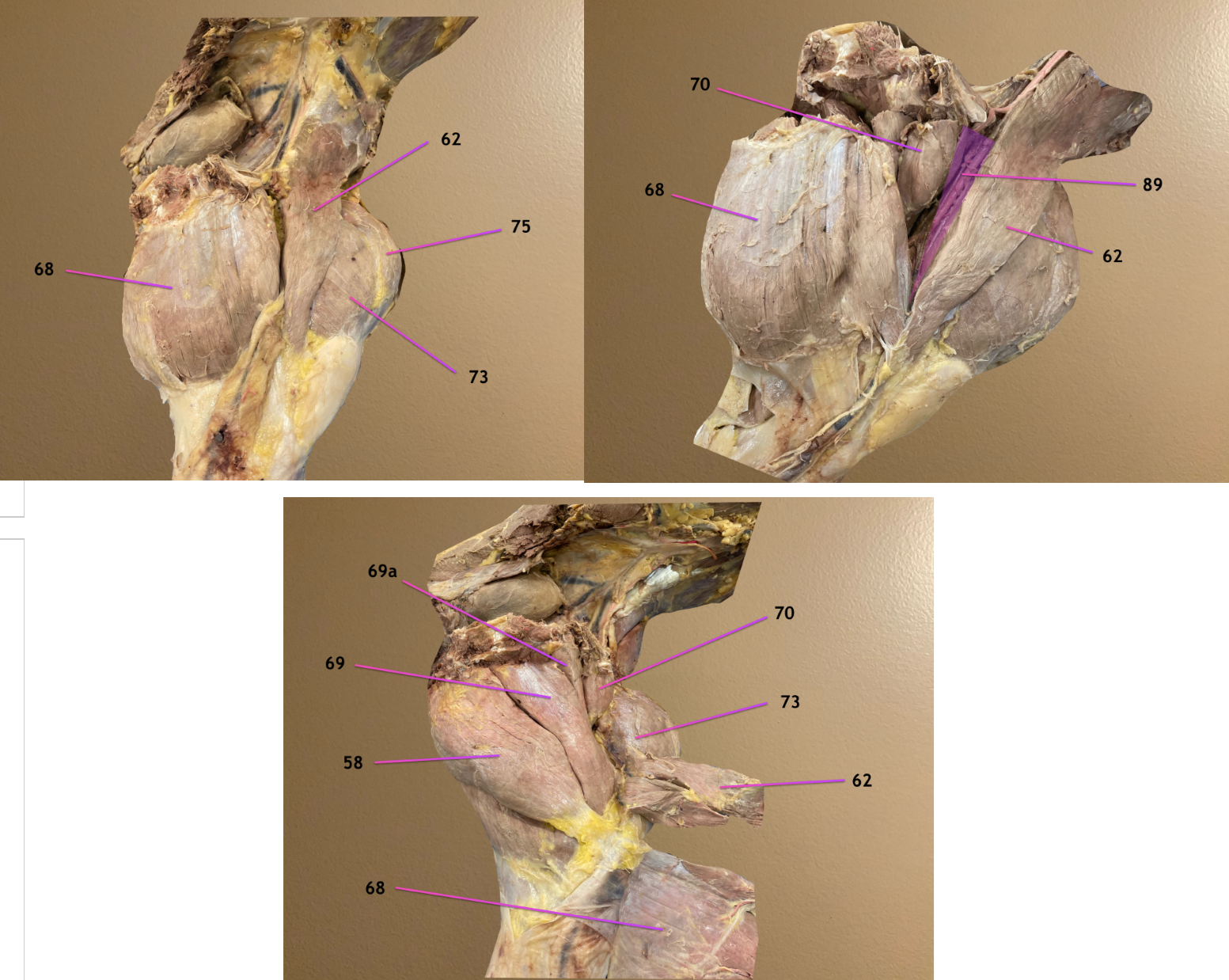 <p>all are medial view of thigh, cranial to rt</p><p>pic 3: 62 &amp; 68 reflected ventrally to reveal deeper structures</p><p>.</p><p>label 58, 62, 68, 69</p>