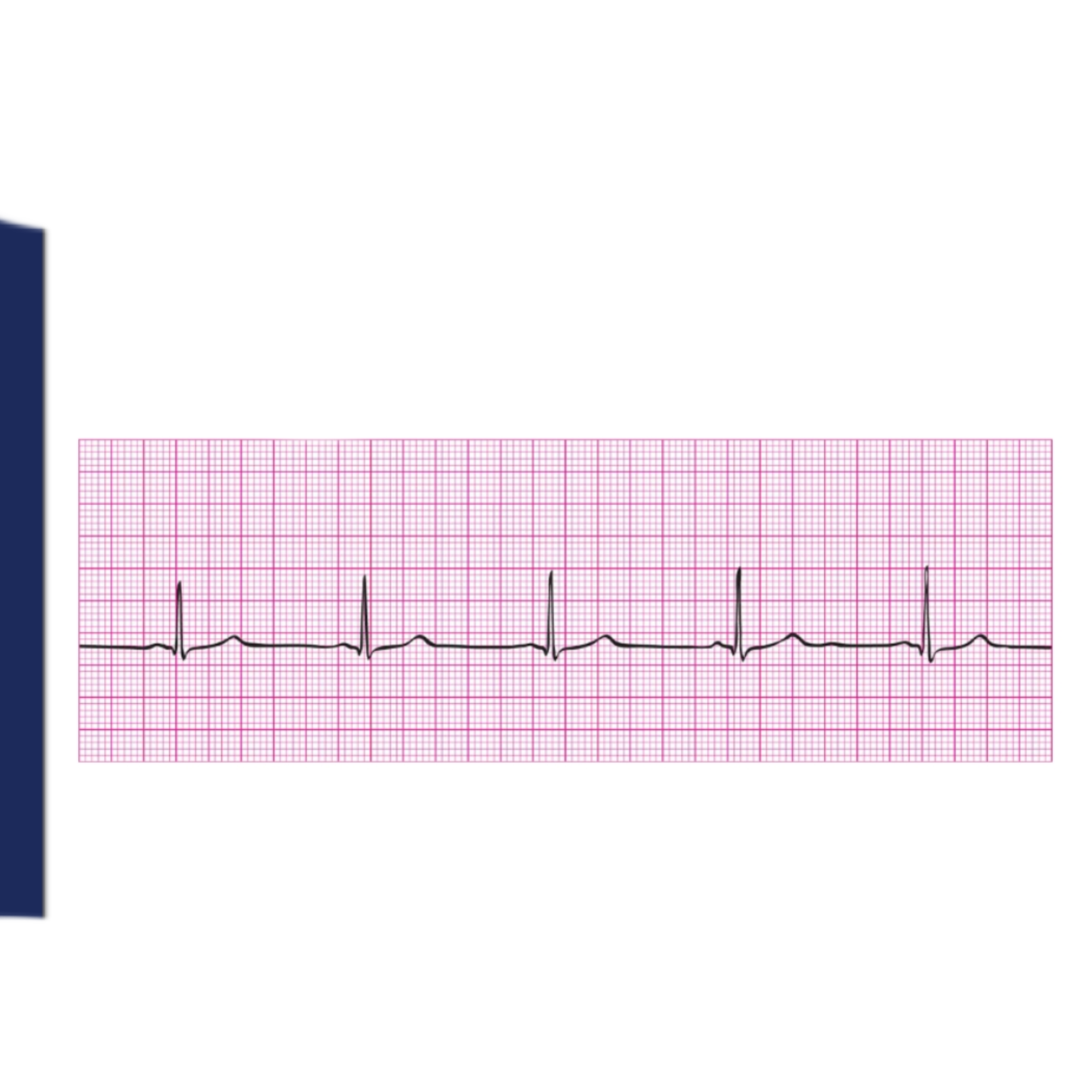 <p>Rules for Sinus Bradycardia includes </p>