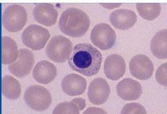 <p>This diffuse cerebral disease leads to aggression, convulsions, *central blindness*, wandering, and head pressing. CBC shows basophilic stippling and nucleated RBCs. Thoughts?</p>
