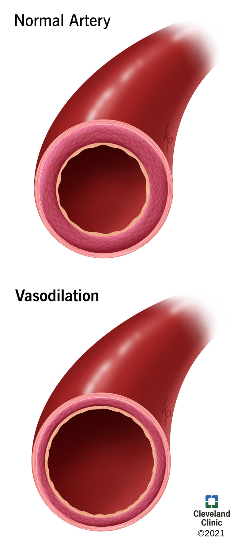 <p>The <strong>widening of blood vessels</strong>, which increases blood flow and can lower blood pressure.</p>