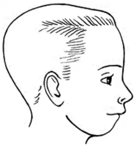 <p>This profile is known as:</p>