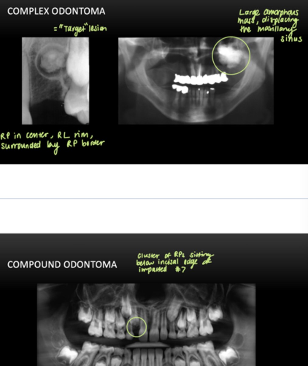 <p>Complex: does not show any tooth-like structures</p>