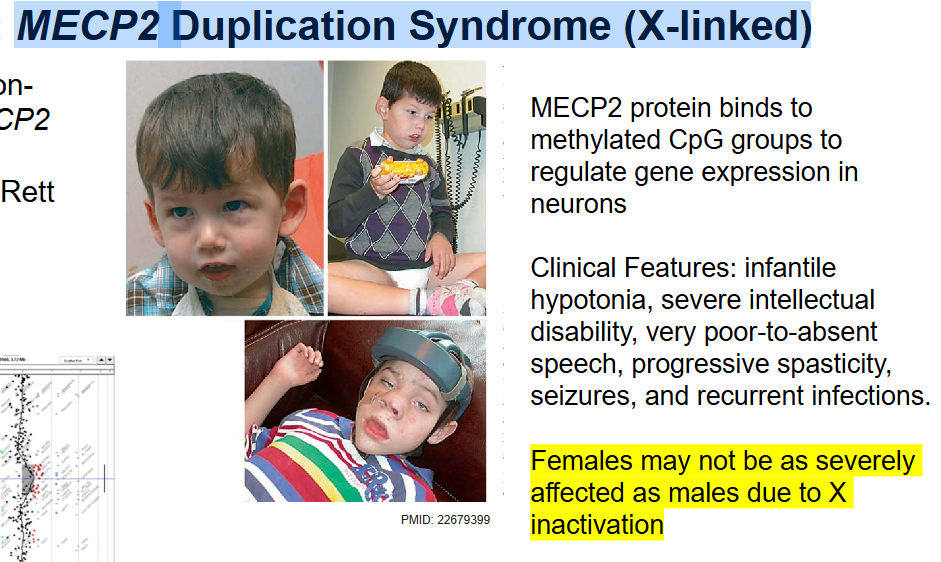<p>MECP2 Duplication Syndrome (X-linked)</p>