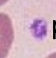 <p>What red blood cell is this?</p>