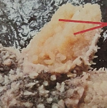 <p>what is this on the sea star</p>