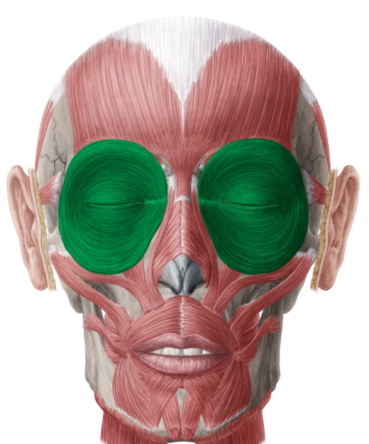term image