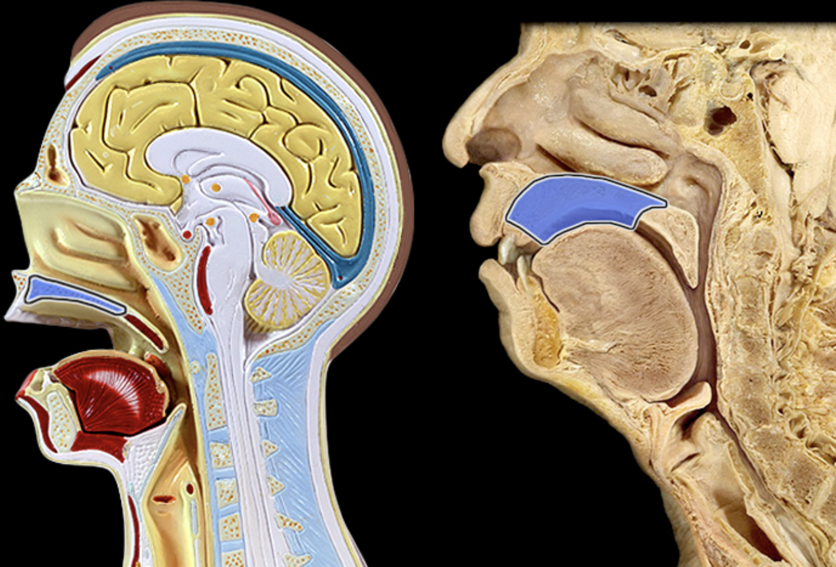 <p>Hard palate </p>