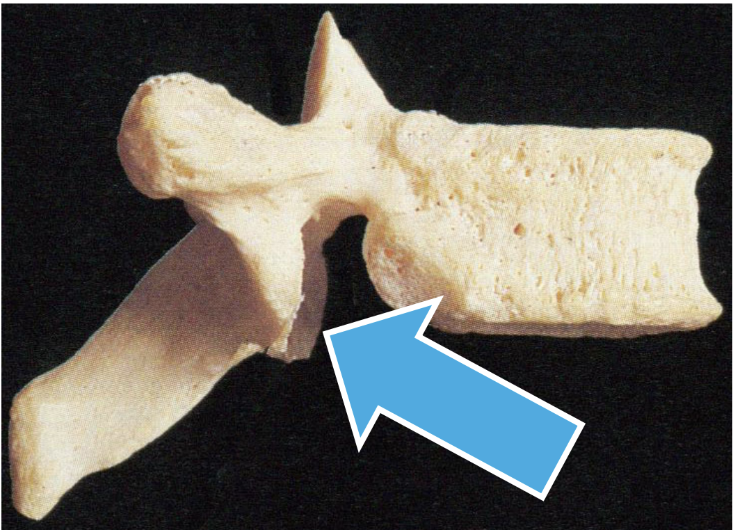 <p>General feature of all three types of Vertebrae</p>