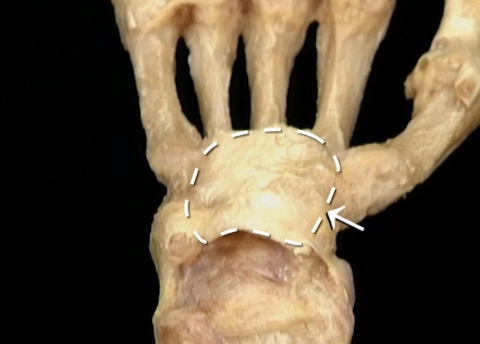 <p>Anterior zicht</p>