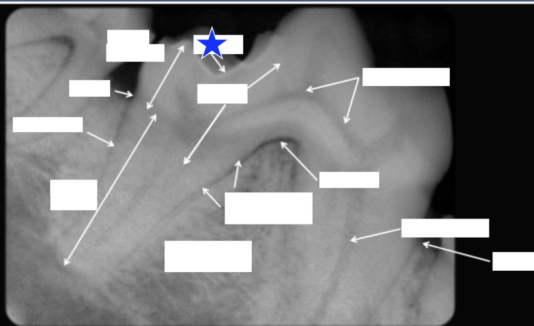 <p>What part of the tooth is indicated by the star?</p>