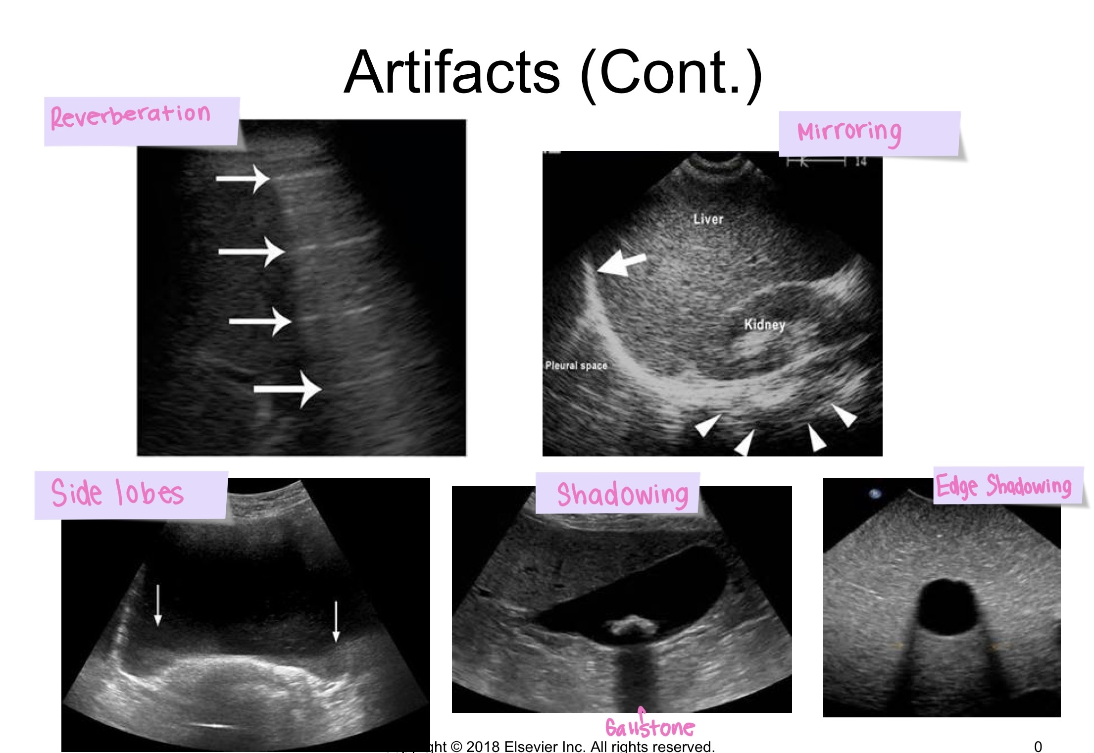 <p>Examples of artifacts are</p>