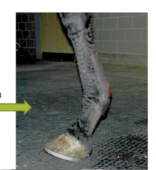 <p>what complication is this after a neurectomy</p>