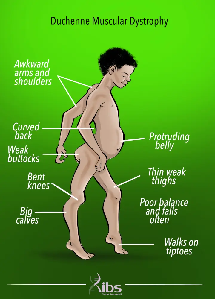<p>A <strong>group of genetic diseases</strong> that cause <strong>progressive weakening and degeneration of muscles</strong>.</p>