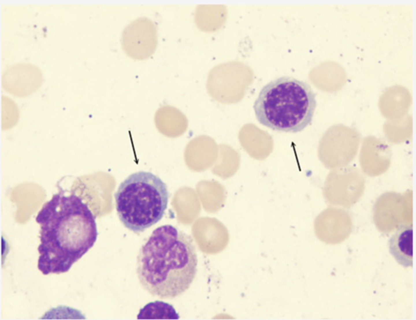 <p>Identify the DEVELOPING Cell</p>