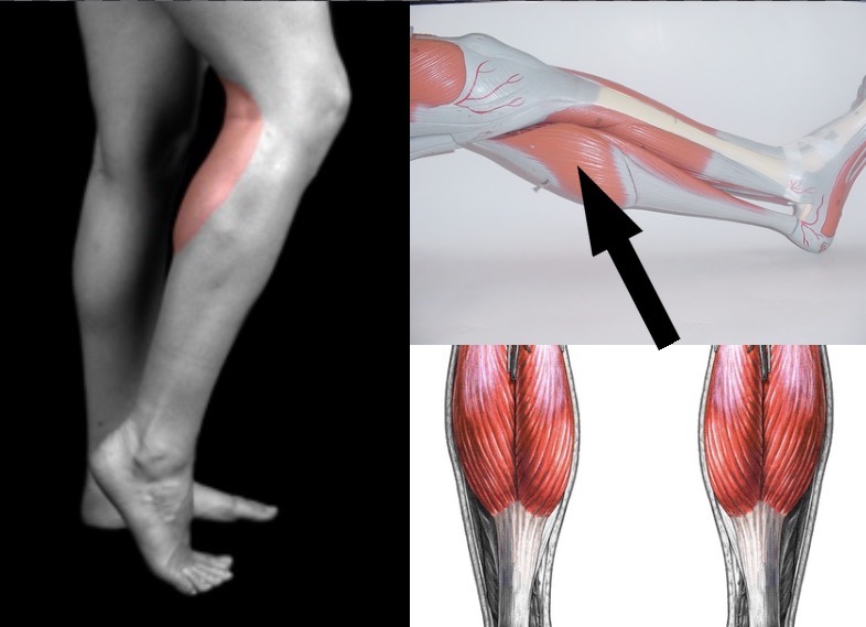 <p>What muscle is this?</p>