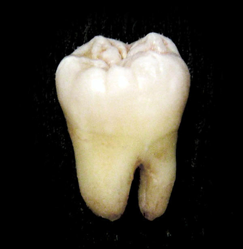 <p>________ is a crown pattern with low, cone shaped or rounded cusps.</p><ul><li><p>Omnivores</p></li></ul><p></p>