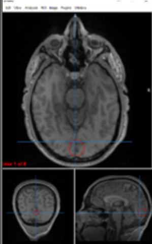<p>primary visual cortex</p>