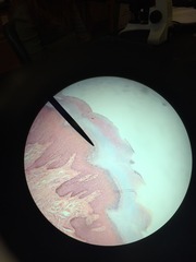 <p>Middle of epidermis</p><p>Distinctive feature: dark stained granules of protein keratohyalin</p>