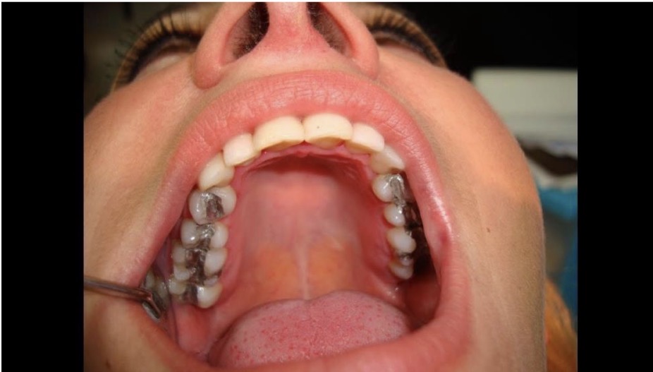 <p>CHẨN ĐOÁN</p>