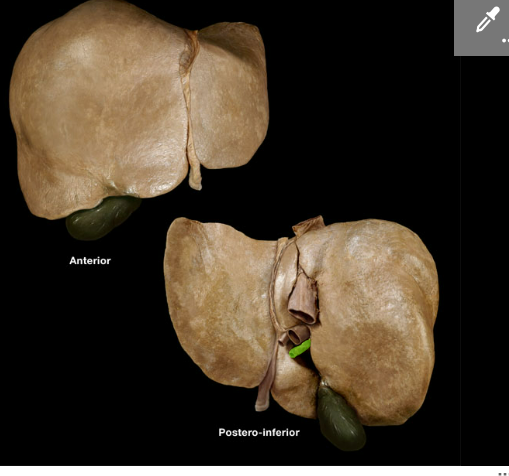 <p><span>Common hepatic duct</span></p>