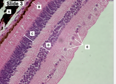 <p>E</p>
