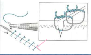 <p>What type of stitch is this?</p>