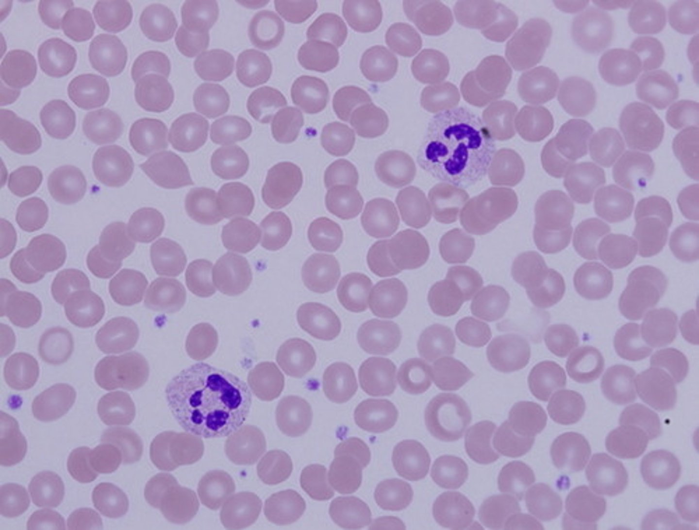 <p>Blood</p>