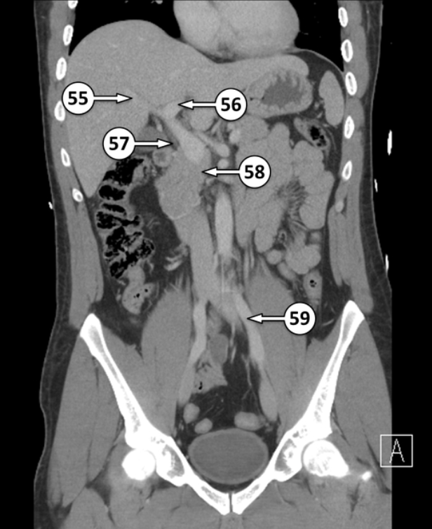 <p>Please label 55 - 58</p>
