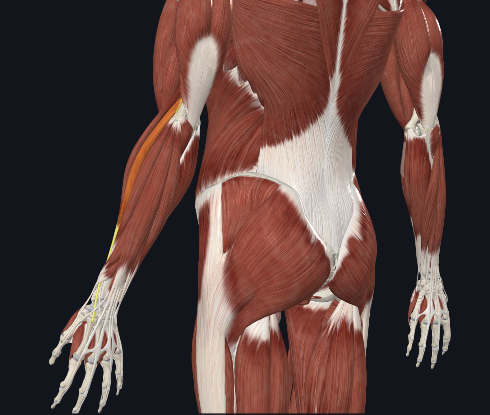 term image