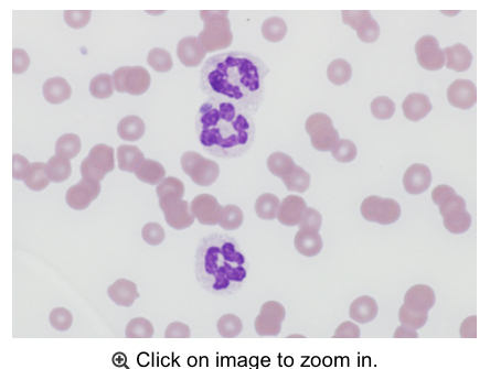 <p>Equine:After doing a blood culture and seeing morula within a neutrophil, how can you confirm this is Anaplasmosis</p>