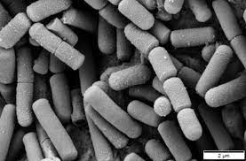 <p><span>The type of bacteria depicted in Figure 4.4 can be best described as…</span></p>