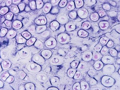 <p>Supportive but flexible</p><p>Elastic fibers</p><p>External ear, larnyx</p>