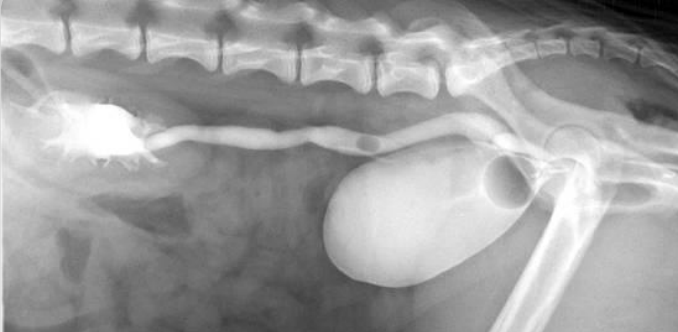 <p>What type of ureter presents clinical signs like urine dribbling due to bypass of the storage unit and urethral sphincter, can leak into the vaginal vault, and may have recurrent UTIs? Females are overrepresented, as well as poodles, huskies, and labs. 80% of dog cases are bilateral, and cats are usually also bilateral. There may be concurrent hypoplastic bladder syndrome as well. This refers to improper anatomic location of the bladder, opening in the urethra or another improper location. Treatment requires neoureterostomy or ureteroneocytsotomy.</p>