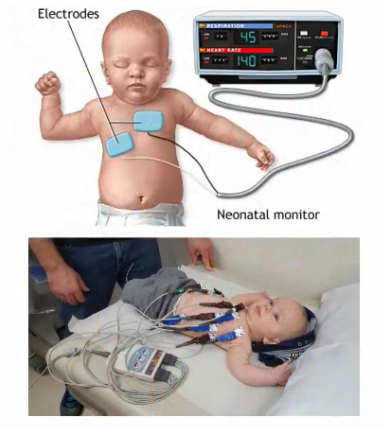<ul><li><p>Measures heart rate</p></li><li><p>Falls with decreased attention, increases with wariness</p></li><li><p>Can even measure feral heart rate - responds to sounds at only 12 weeks gestation</p></li><li><p>Can be combined with other measures</p></li></ul><p></p>