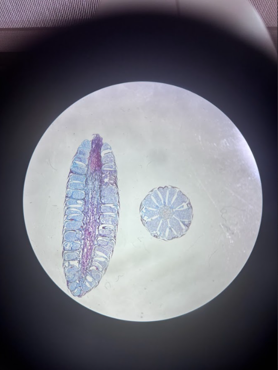<ul><li><p><strong>Diploid</strong></p></li><li><p><strong>Sporophyte</strong></p></li><li><p>Produces <strong>microspores</strong> (haploid)</p></li><li><p>Microspores → develop into <strong>microgametophytes</strong> (pollen grains)</p></li><li><p>Small, soft, short‑lived cones</p></li></ul><p></p>