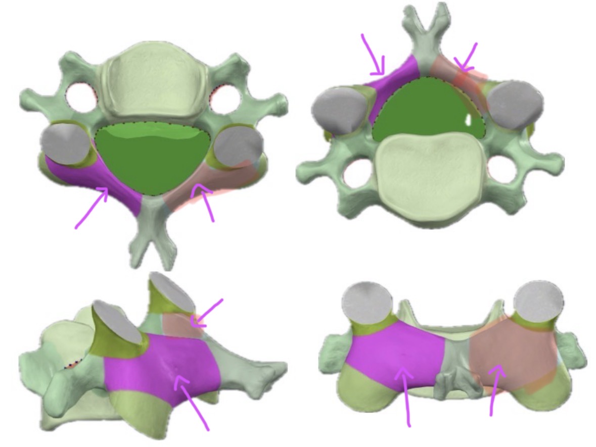 <p>What part of the bone is this?</p>