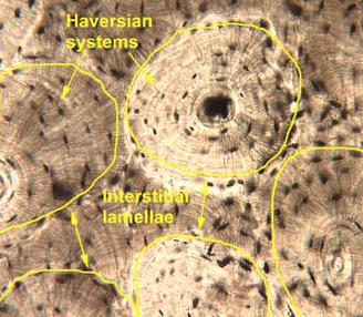 <p>Target-like nested layers of bone matrix arranged in concentric rings around a central canal</p>