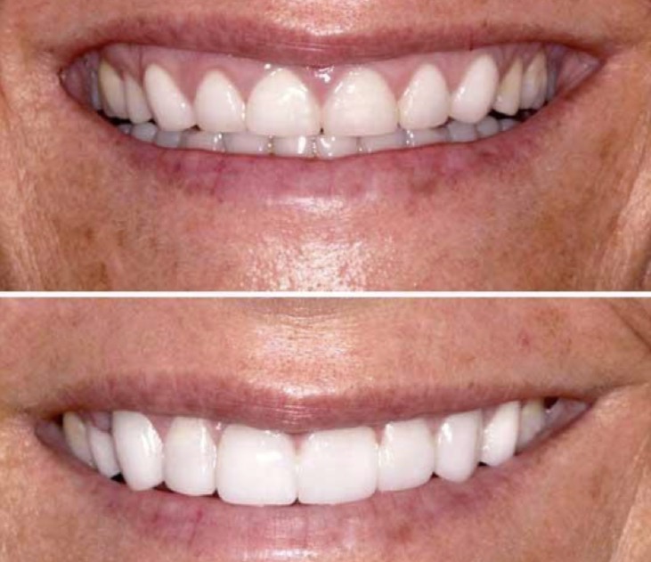 <p>What dental specialty is being displayed here?</p>
