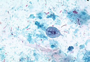 <p><span style="background-color: rgba(0, 0, 0, 0); line-height: 19.7625px;">What is the species in this photo?</span></p>