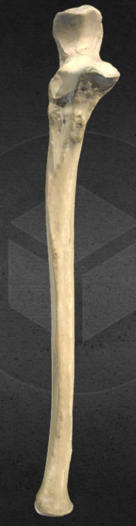 <p><strong>These bones came from the ________ side of the body.</strong></p>