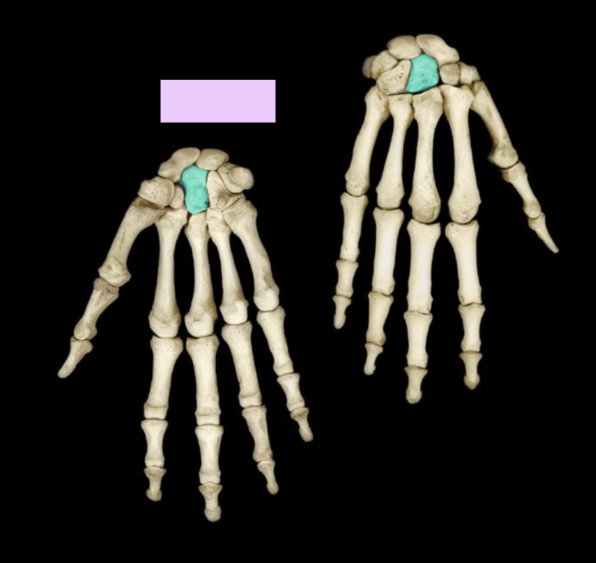 <p>What structure is highlighted?</p>